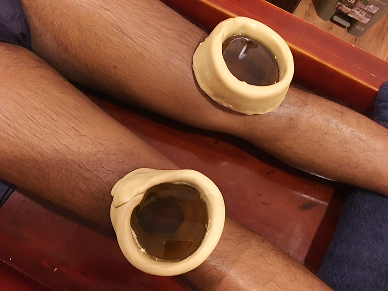 Januvasti Ayurveda Treatment for chronic knee pain