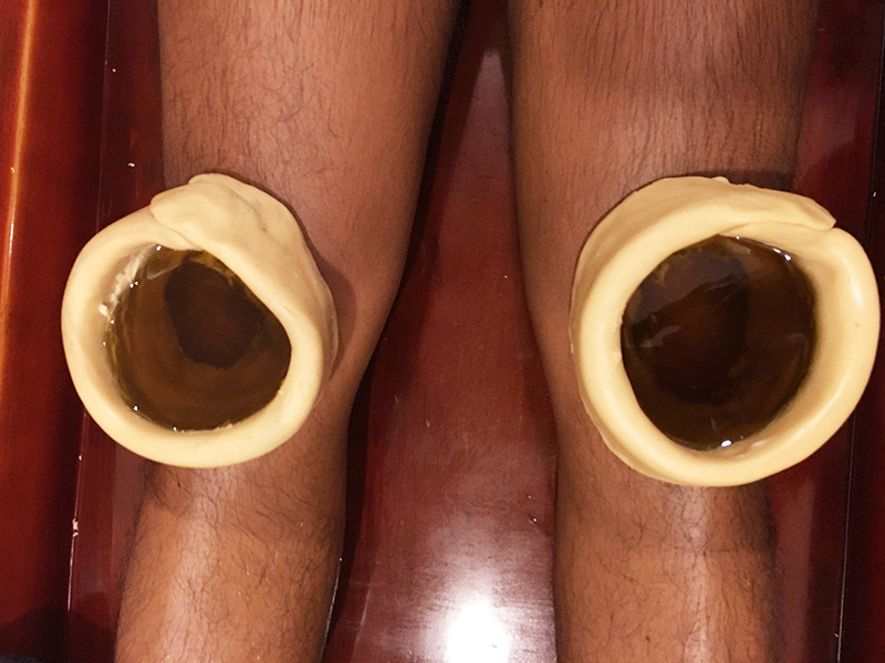 Januvasti- Specialized ayurvedic treatment to relieve the knee pain & Joint Pain